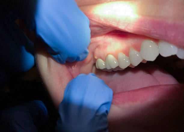 Best Weekend Emergency Dentist in Rosendale, WI