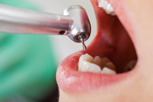 Best Pediatric Emergency Dentist in Rosendale, WI